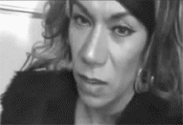 janinchorea.gif